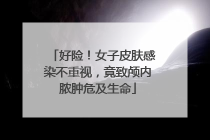 好险！女子皮肤感染不重视，竟致颅内脓肿危及生命